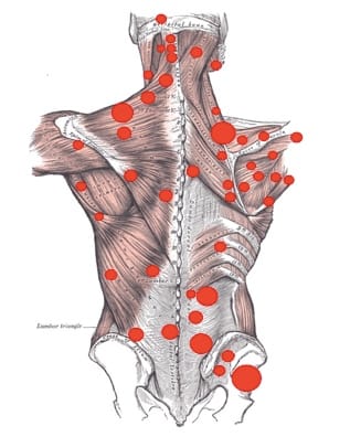 Trigger points